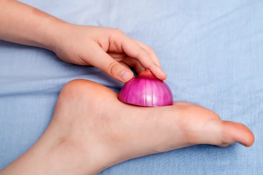 Hand legt eine aufgeschnittene rote Zwiebel auf die Fußsohle – ein traditionelles Hausmittel zur natürlichen Linderung von Mückenstichen.